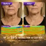 EPRHAN Neck Mask Kit – Revitalize Your Neck with Collagen & Peptide Serum Hydrogel Masks for Youthful, Smooth Skin (7 Sheets) - Image 4