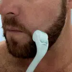 Microneedles Derma Roller for Hair Beard Facial Skin Men Women - Image 6