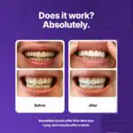 Purple Teeth Whitening Strips – Enamel Safe Dental Whitening Strips for Brighter Smile at Home - Image 4